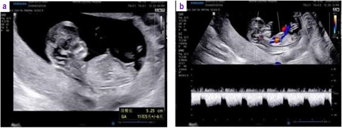 Figure 3