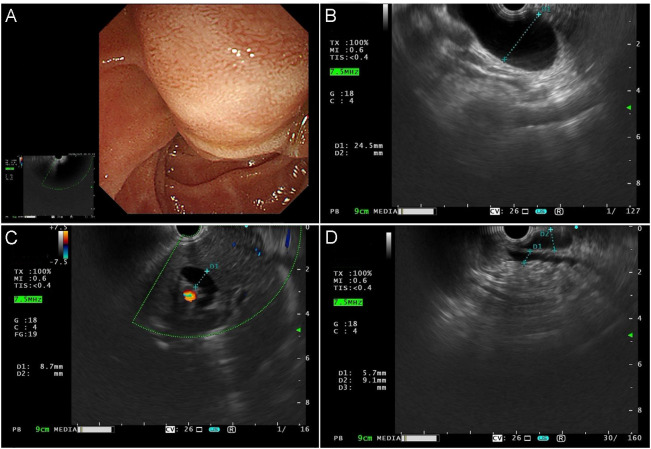 Figure 1