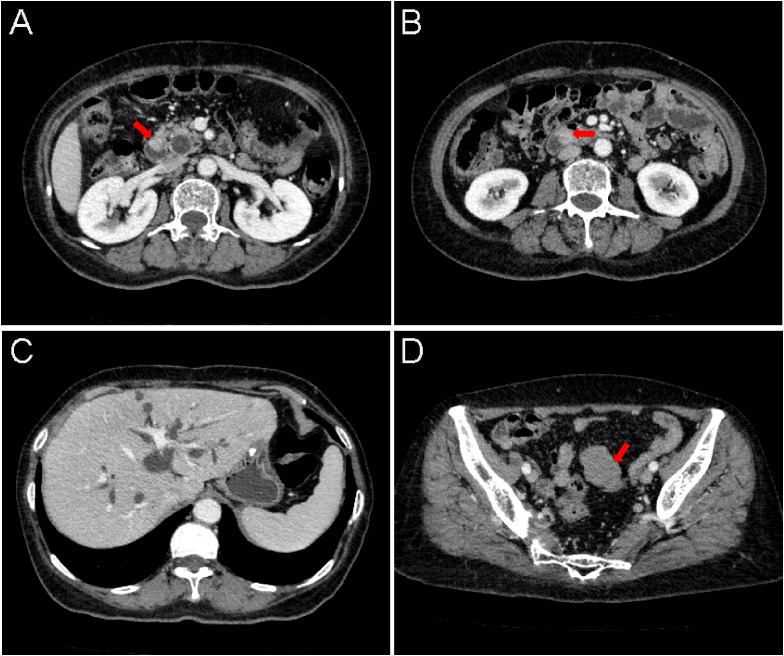 Figure 2