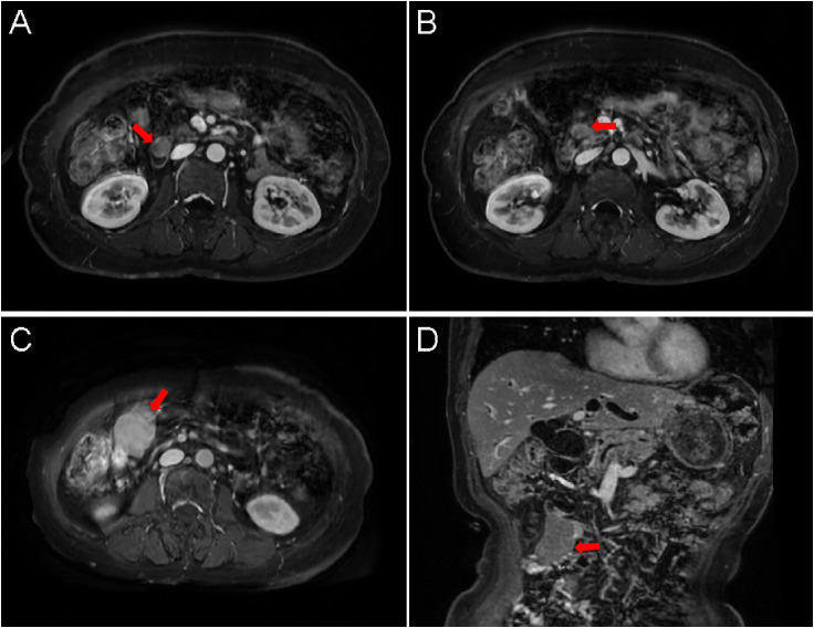 Figure 3