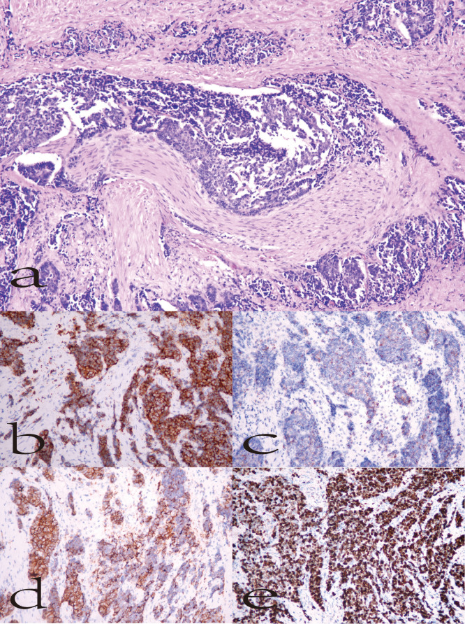 Figure 2