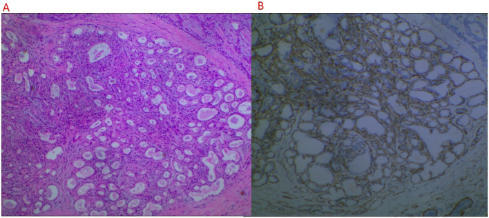Figure 4