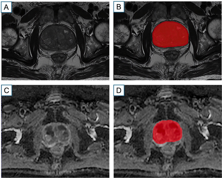 Figure 2