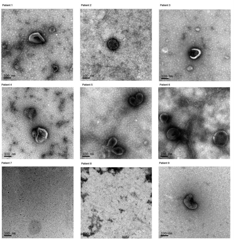 Figure 1