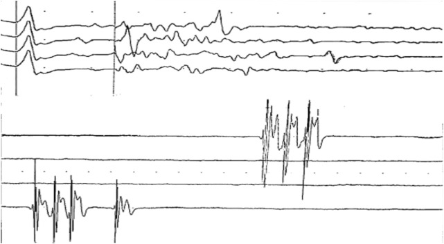Figure 1