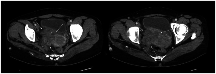 Figure 2