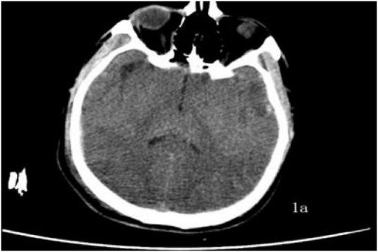 FIGURE 1