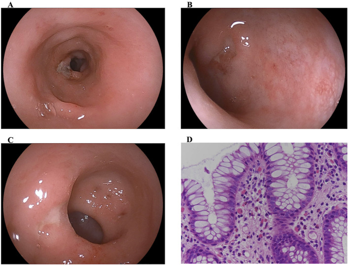 Figure 2