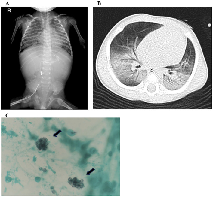 Figure 3