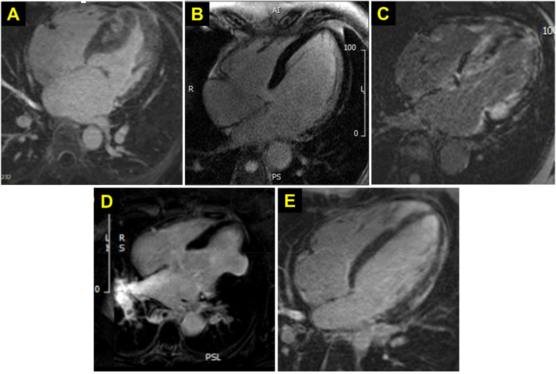 Figure 3