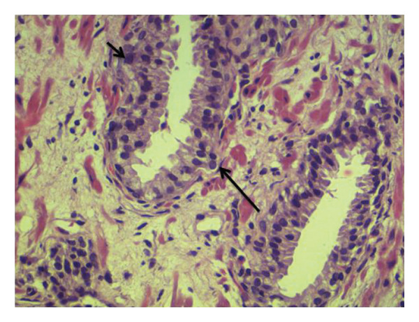 FIGURE 3