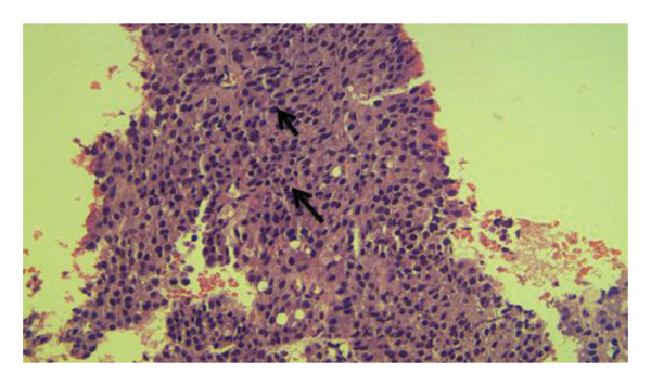 FIGURE 2