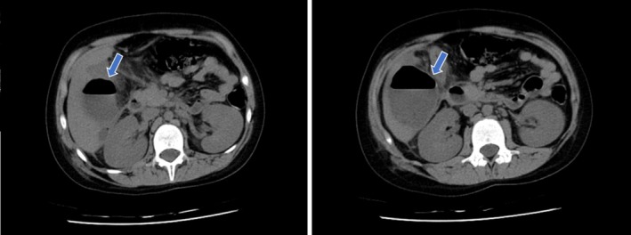 FIGURE 1