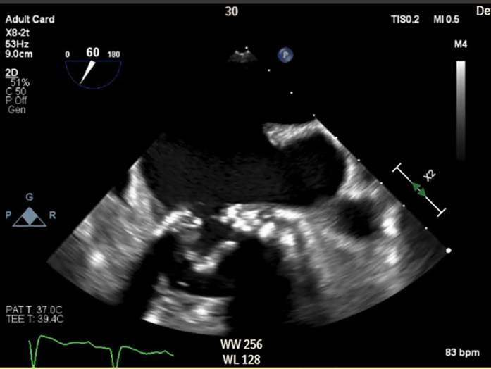 Figure 5