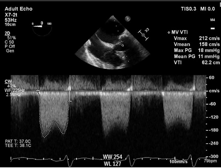 Figure 6