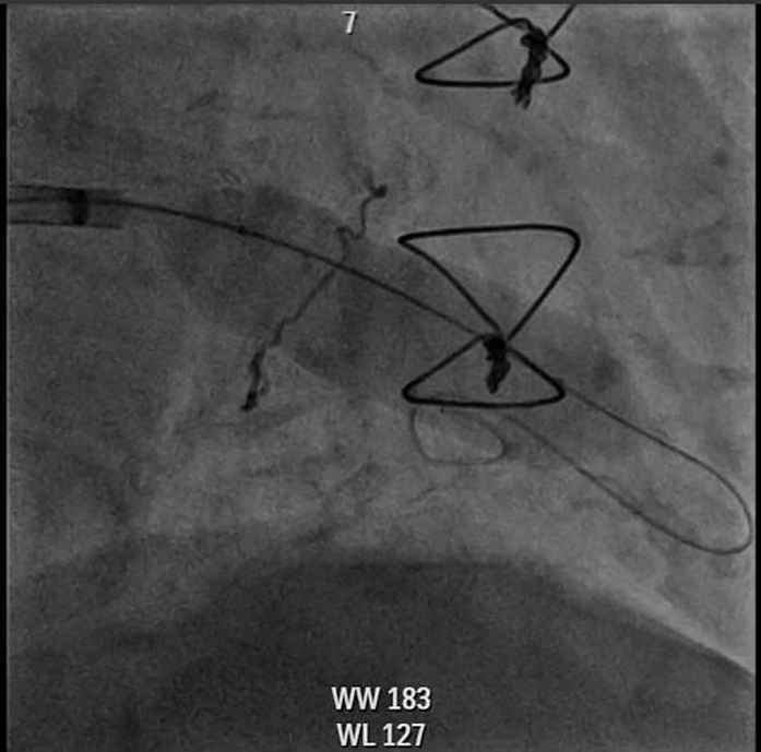 Figure 10
