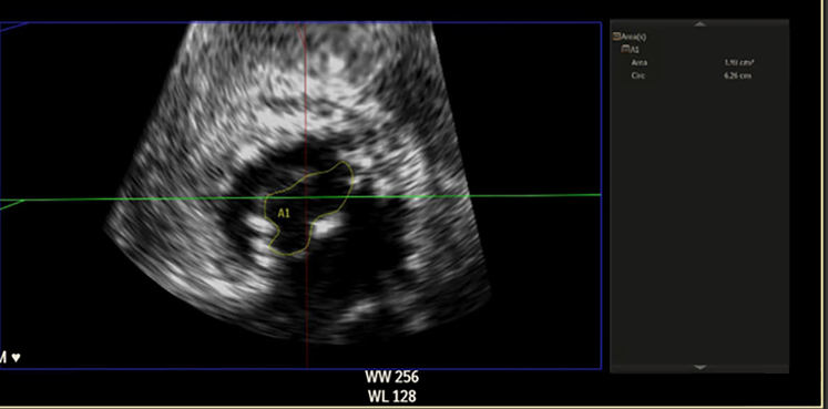 Figure 12