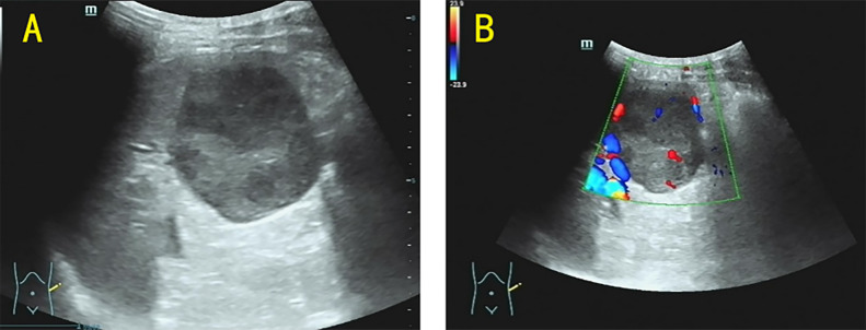 Figure 1