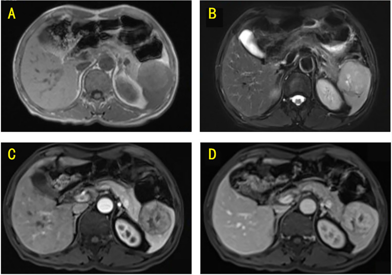 Figure 2