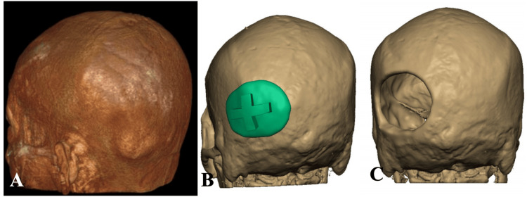 Figure 9