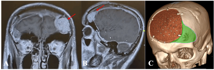 Figure 11