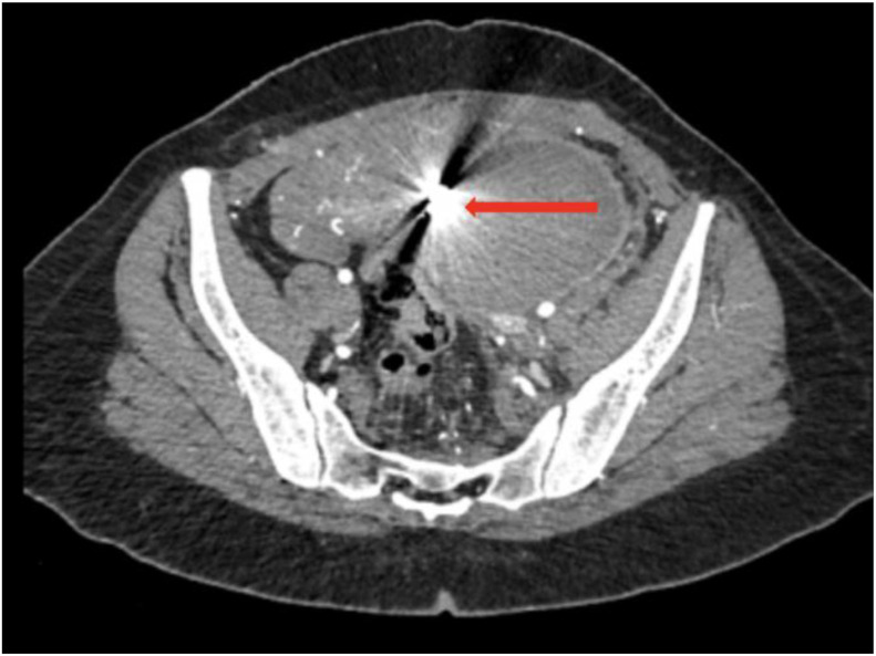 Figure 5