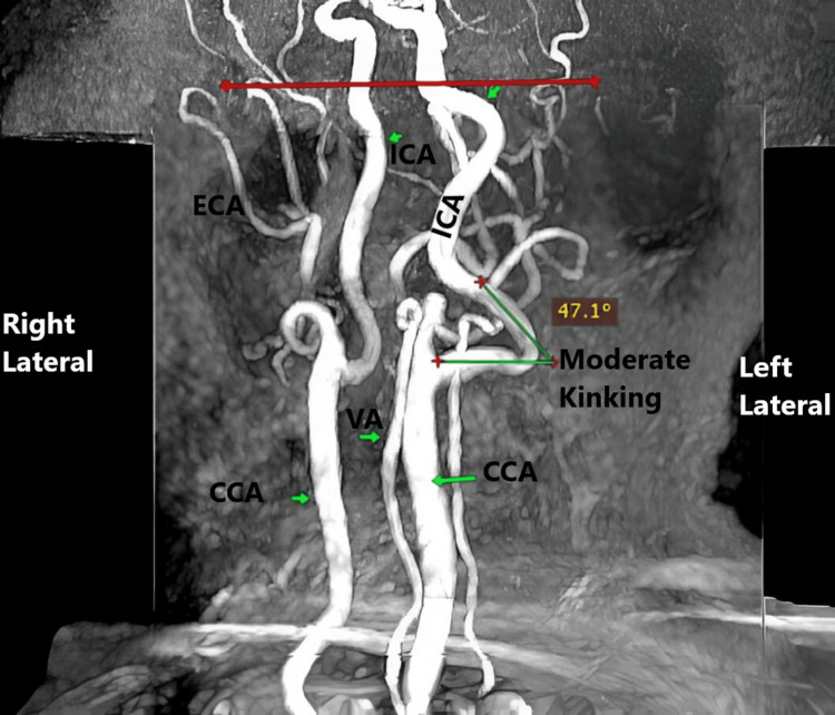 Figure 7