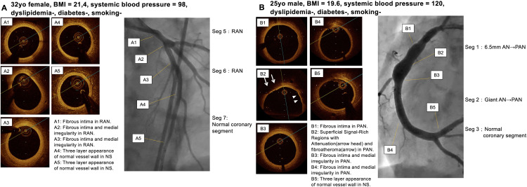 Fig 3