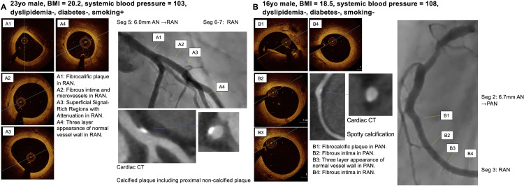 Fig 4