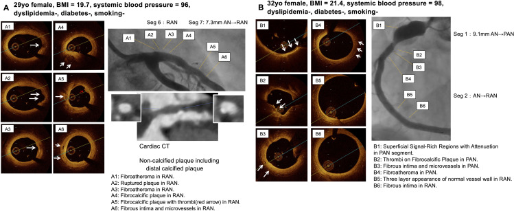 Fig 5