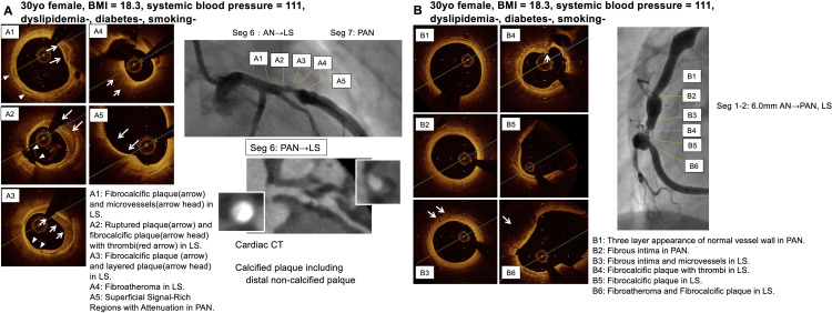 Fig 6