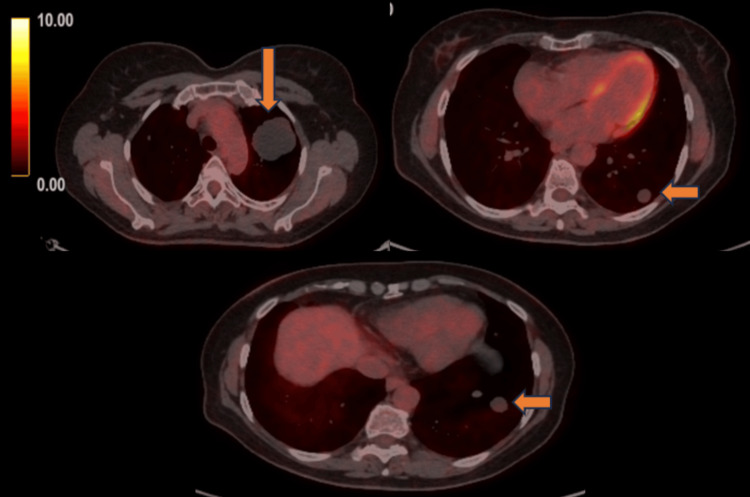 Figure 5