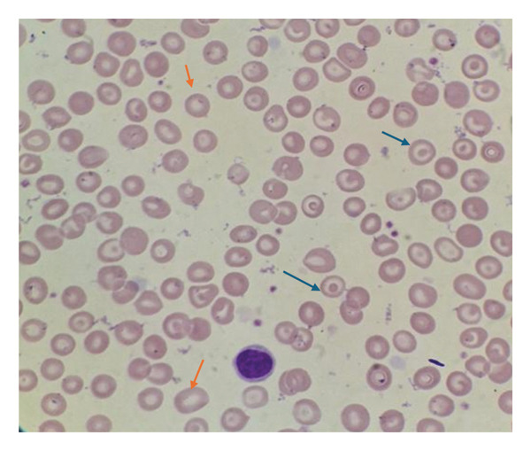 FIGURE 1
