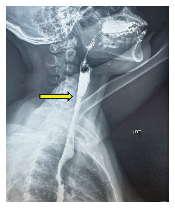 FIGURE 2
