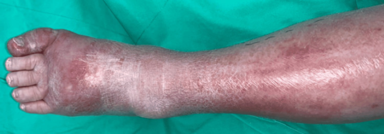 Figure 13