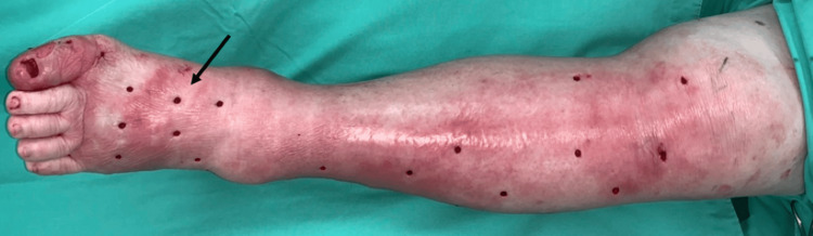 Figure 14