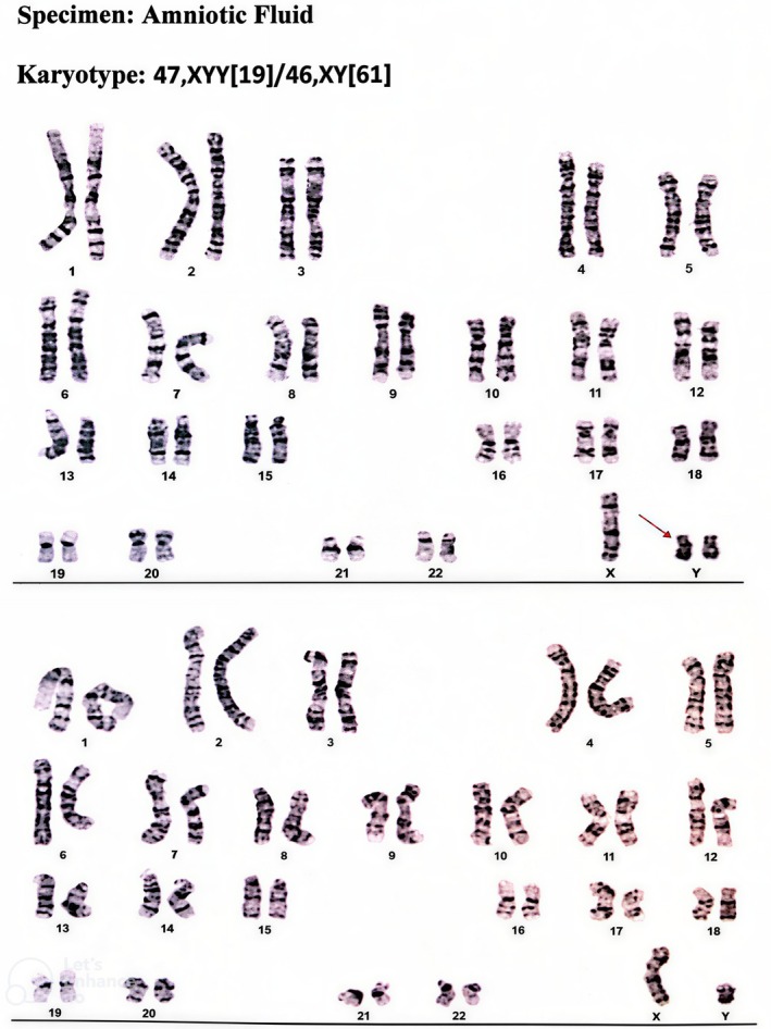 FIGURE 1