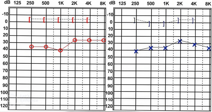 FIGURE 3