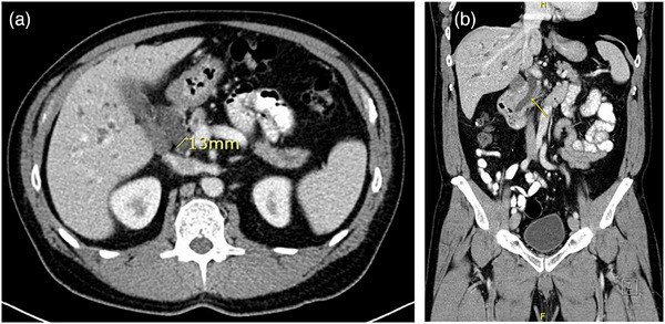 FIGURE 1