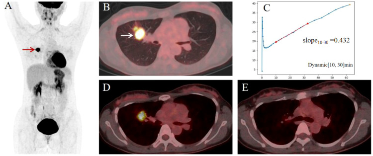 Figure 3