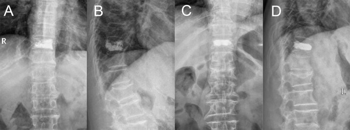 Figure 2