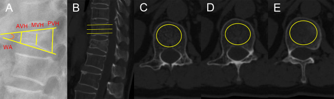 Figure 3
