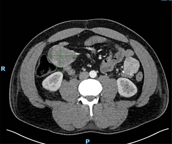 Figure 2