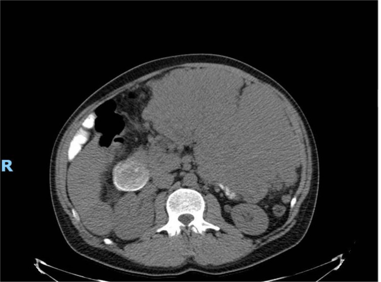 Figure 4