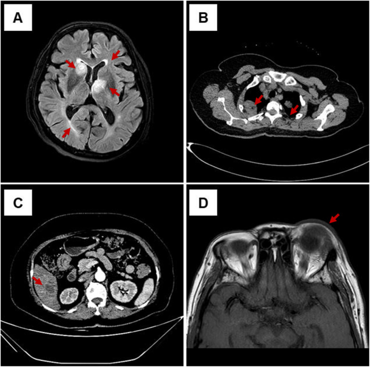 Figure 1