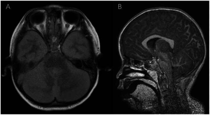 FIGURE 2