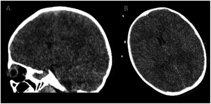 FIGURE 1