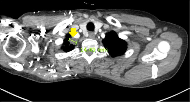 Figure 2