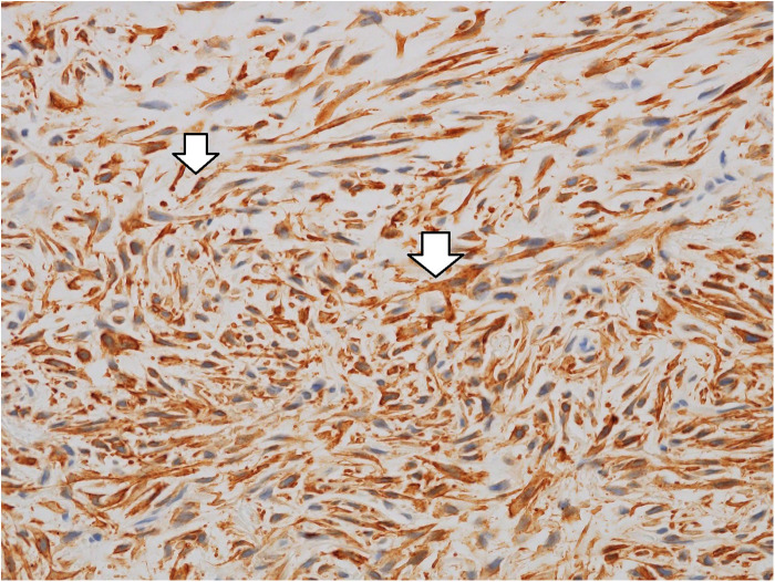 Figure 3