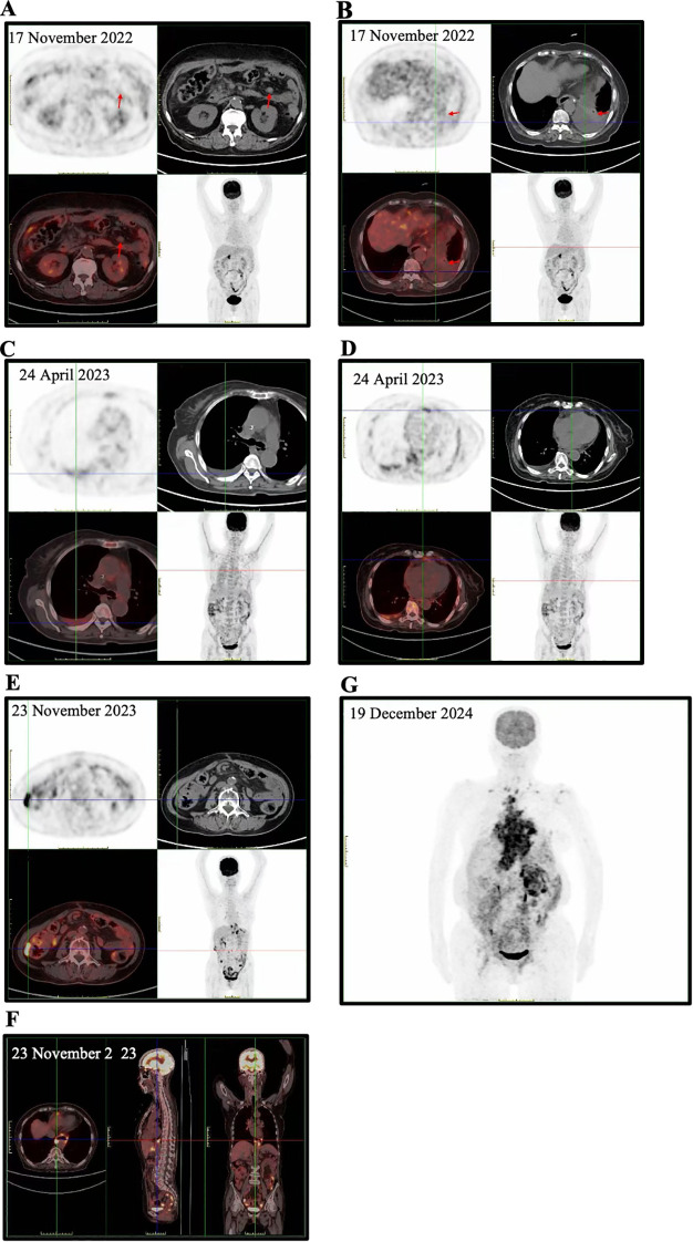 Figure 2